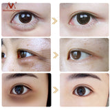 Eye Cream  for Anti-Puffiness Remove Wrinkles