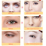 Gold Crystal Collagen Eye Mask Patches for Brighter, Younger-Looking Eyes